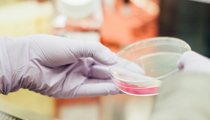 Petri dish-study gyn cancer
