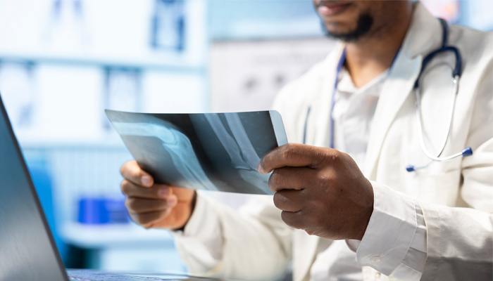 AI radiology diagnostics